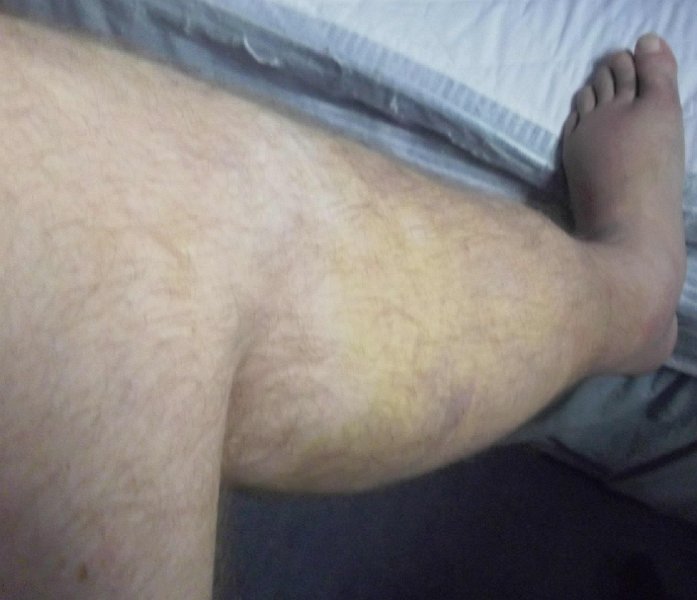 Tuesday 26th June 2012 x3.JPG - Is that a natural colour?